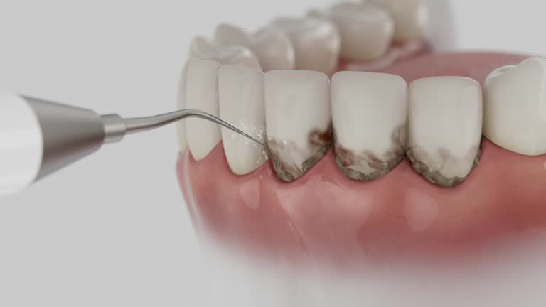 Reliable Emergency Dentist contractor in Clarks Summit, PA by Smile Center Dentistry